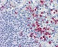 MMP9 / Gelatinase B Antibody